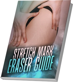 Stretch Mark Eraser Guide bonus guide cover